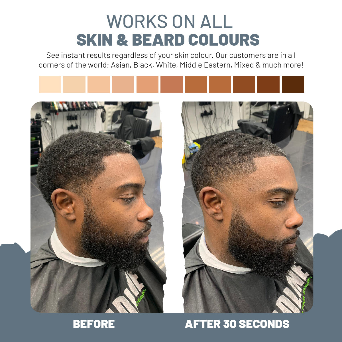 Beard Filling Starter Kit